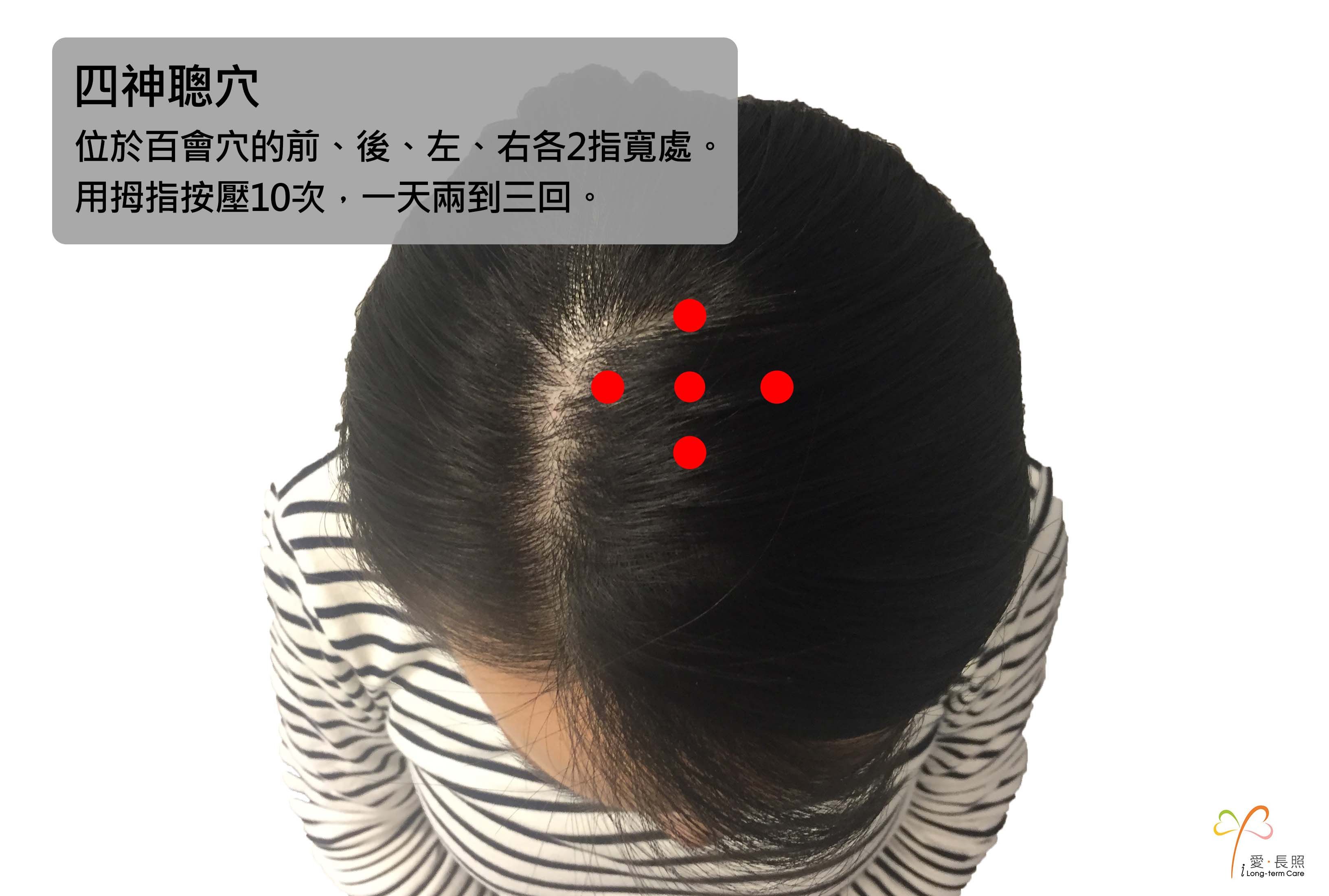 老化