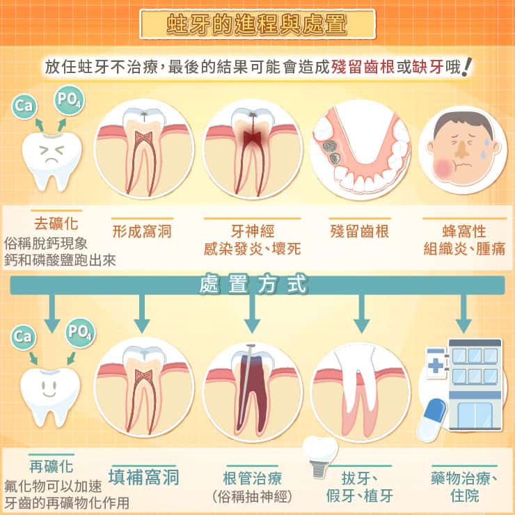 蛀牙的進程
