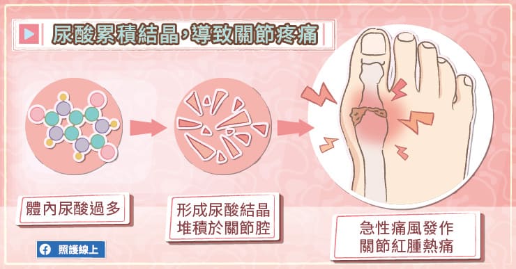 關節