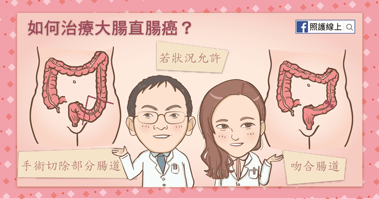 發生率第一名的癌症–大腸直腸癌(懶人包)–照護線上 大腸直腸癌