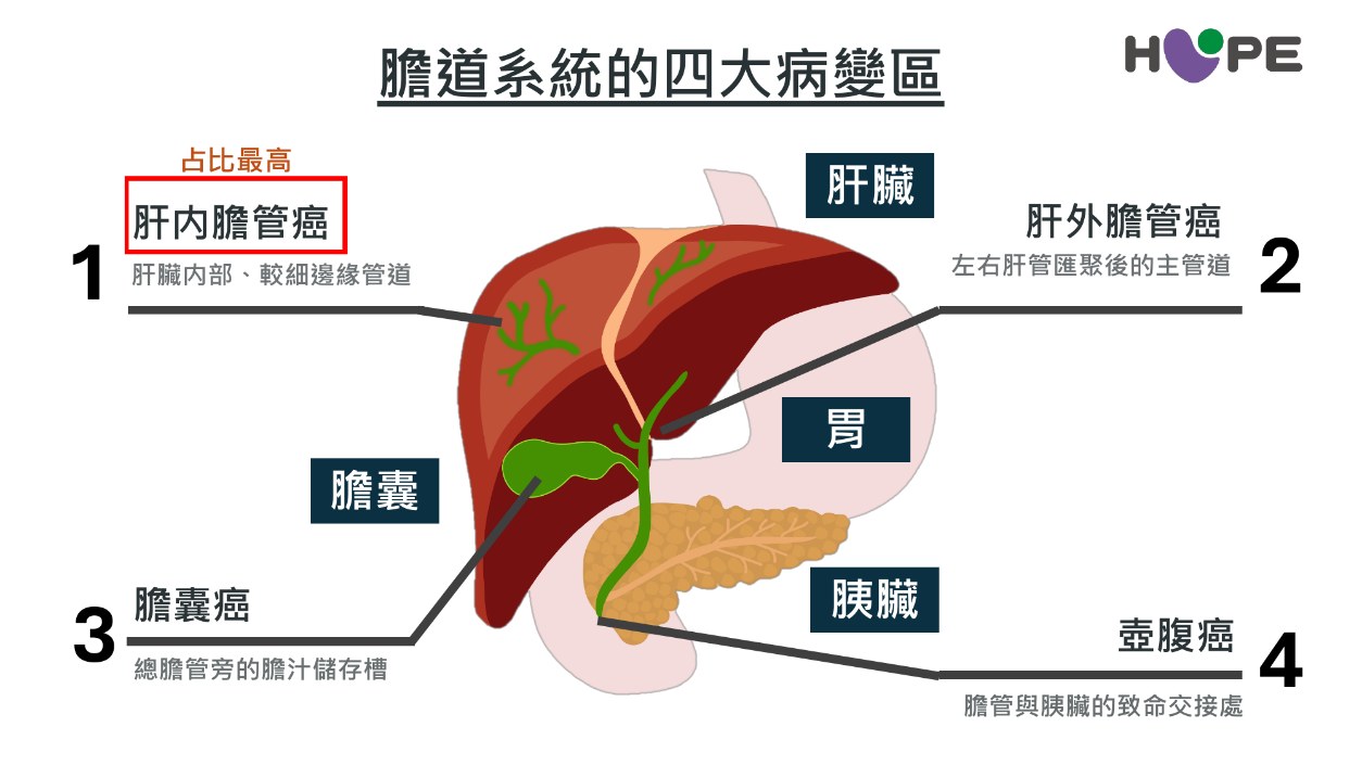 膽管癌難手術怎麼辦？基因檢測找出更多治療可能