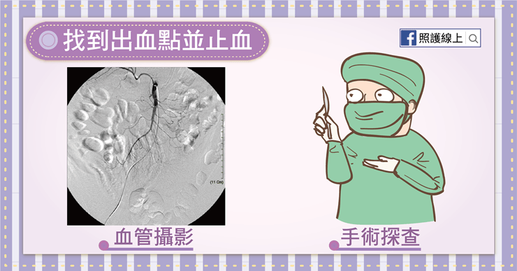 大腸鏡
