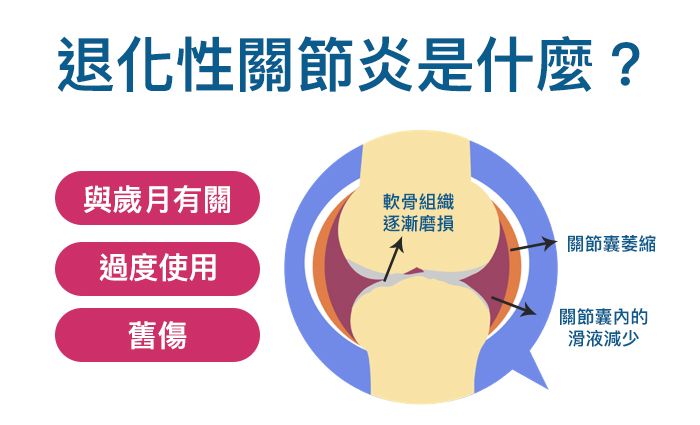 退化性關節炎