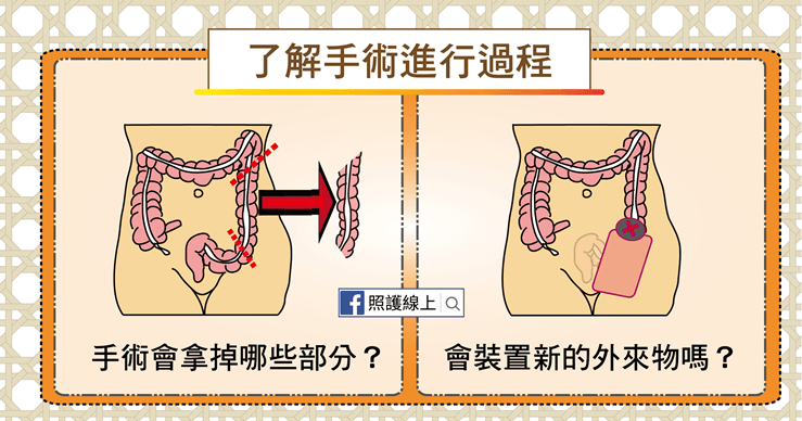 手術