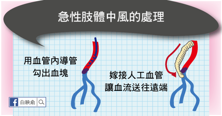 中風
