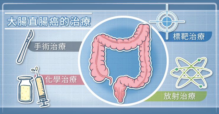 大腸直腸癌