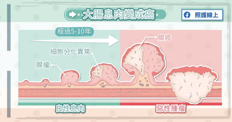 大腸鏡