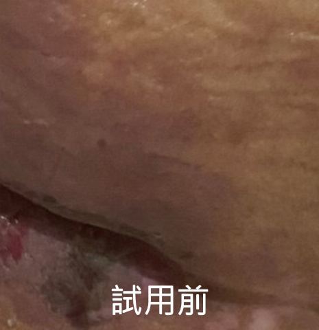 試用者實拍