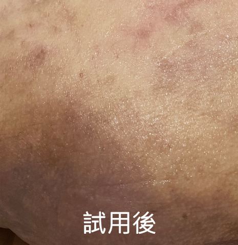 試用者實拍