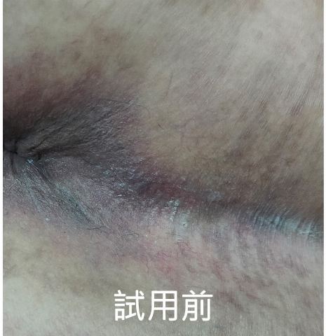 試用者實拍