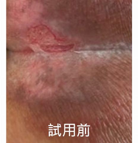 試用者實拍