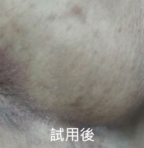 試用者實拍