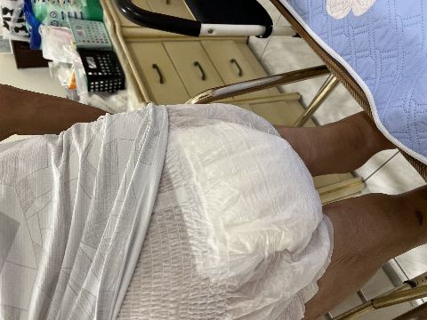 試用者實拍